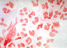 Gram Negative Bacteria