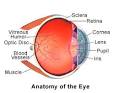 <b>Iritis</b> is inflammation of your