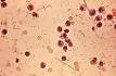 Shigella - Wikipedia, the free encyclopedia