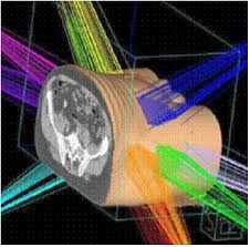 Qvision La radioterapia puede ayudar en la orbitopatía de Graves images?q=tbn:ANd9GcQxcmS xq JIAk6FJcADgwGuqvx2IWBLujFcGWJE6UVTIFCwcuSh92L8 s