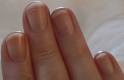 Achieve Beautiful Fingernails | Supernatural Botanicals