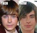 Zac Efron before and after
