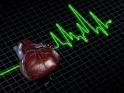 Myocardial <b>Infarction</b>