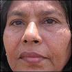 Nisha Bagale