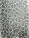 CDC - Giardia - <b>Epidemiology</b> & Risk <b>Factors</b>