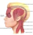 Headaches, tension
