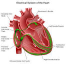 Arrhythmias