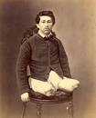 Trauma and Surgery: Medicine During the Civil War | n m h m