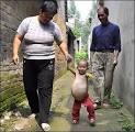 Ritemail: Kang Mengru found parasitic twin inside
