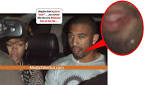 Aisha: Rihanna's Boyfriend Sporting Herpes Sore
