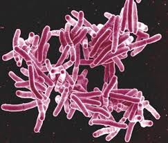 Europa se enfrenta a un repunte de la tuberculosis Images?q=tbn:ANd9GcR3u9IAk1oH9gKjmAcQ7XLsVOmjtAw7C91s852Chyst5osb7gd3yw