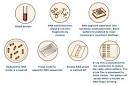 Dna Finger Prints,technique of Dna Finger Printing | Tutorvista.