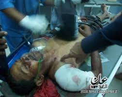 الى من اراد الحقيقه عن المظاهرات والقتل وكل ما يحدث في اليمن حالياً (الوجهه الحقيقي) Images?q=tbn:ANd9GcR7EV4FF4o_06APUSj58_niJ-7kdOO7UYz3oJhyR2BHBdZJ08sB&t=1