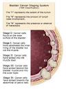 Bladder Cancer Staging, Grading and Prognosis?> - Health ...