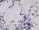 Clostridium Difficile | Humen Healths