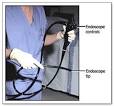 What is EGD (upper endoscopy)