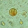 <b>Amebiasis</b> - Microscopy