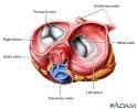 Heart valves - superior view: MedlinePlus Medical Encyclopedia Image