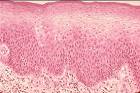 Epithelial Tissues