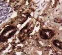 del <b>amiloide</b> (Rojo Congo.