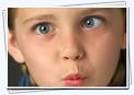 Strabismus