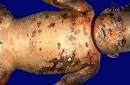 Forensic Pathology