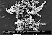 Clostridium difficile - Wikipedia, the free encyclopedia