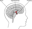 Images of the Glands in the Body / Cushing's Help and Support