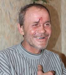 images?q=tbn:ANd9GcRFNAMVzMEjZ-PCrhXx3ph4bwCl_SnZ4XZ7rqEEyFETdWjQbpRYEQ