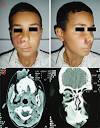 consultant pour <b>une tumeur</b>
