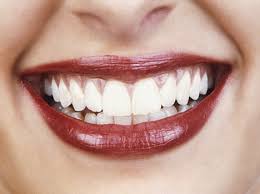 وصفات طبيعية لتبييض الأسنان Images?q=tbn:ANd9GcRIoqPjeYWcUyYqetns01T7VtXh5rVMNY4R2f2QN7BcmEghHB3VpDtkZFwi