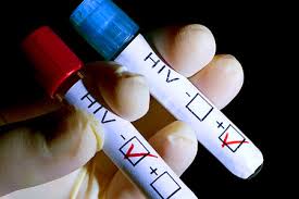 How the HIV virus affects the body