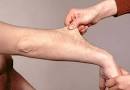 Doctors Gates: Ehlers-Danlos Syndrome