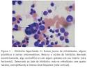 da <b>pancitopenia</b> e da