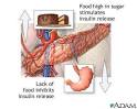 Are There Certain Foods That Make Insulinomas Release Insulin ...