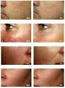 Leyla Laser-IPL & Skin Care Clinic