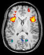 Neuroimaging - Wikipedia, the free encyclopedia