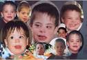 Mental Retardation | psychologyface.