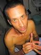 Jaundice: 12 Answers