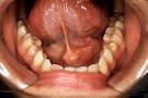 to the <b>sublingual gland</b>.