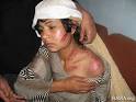 http://www.rawa.org/images/violence.jpg
