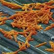 Lesser-known C-diff a bigger hospital threat than MRSA? - USATODAY.