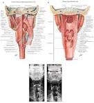 Figure 2 | Radiographic evaluation of motility of mouth and ...