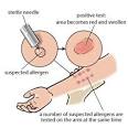 Indiana Allergy Skin Testing