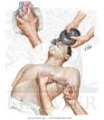 Cardiopulmonary Arrest and Treatment - Internal Cardiac Massage ...