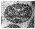 History of Plagues