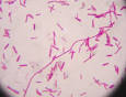 Clostridium botulinum
