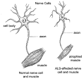 What is ALS? - The ALS Association