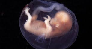 images?q=tbn:ANd9GcR_JZXH_HeSypg2Tmwn7GDA-lPchdjtkIvPlFRfio_tun4Ld_MC&t=1