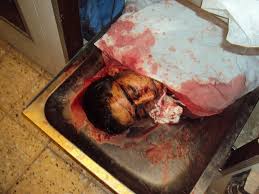 بالصور قصف طيران حربي على المتظاهرين السلميين في ليبيا ووقوع مجازر Images?q=tbn:ANd9GcR_m5E5Dm8gSDU2VhvZsx3eFNw8YZ9qDn1gxfa1LVobI_KtKy7tJw